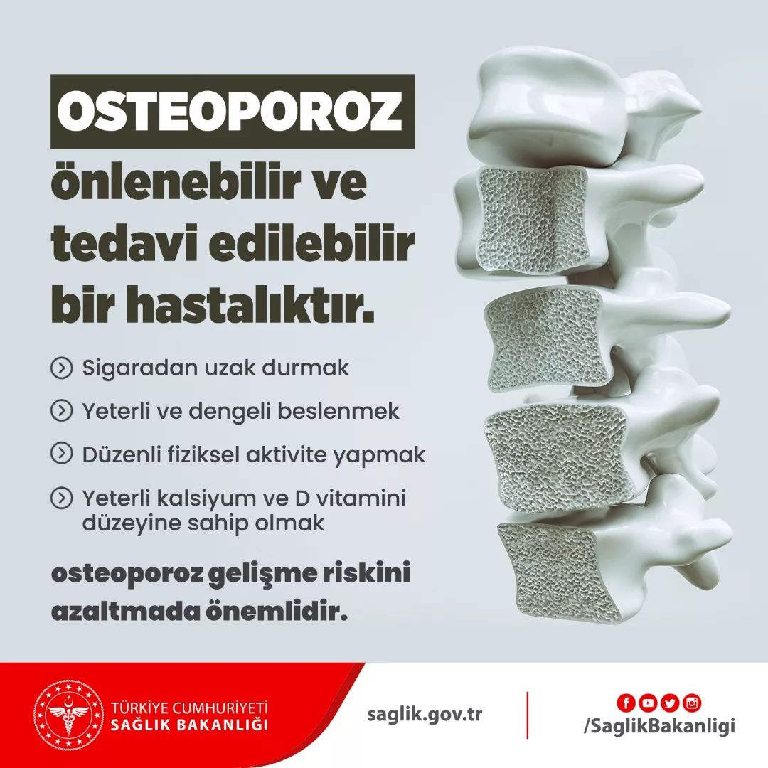 Osteoporoz